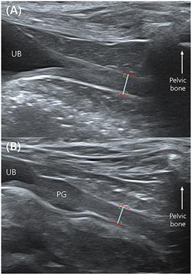Evaluation of urethral thickness using ultrasonography in healthy small-breed dogs